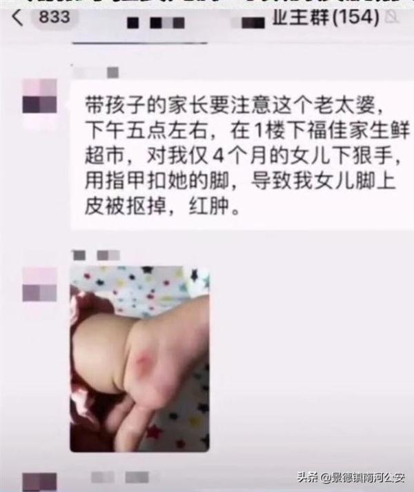 “抠掉婴儿脚皮的大妈”被厦门警方拘留