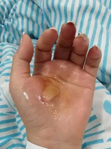 滚烫的水,从头流到脚!今晚洗澡前紧急提醒! 滚烫的水,从头流到脚!今晚洗澡前紧急提醒!