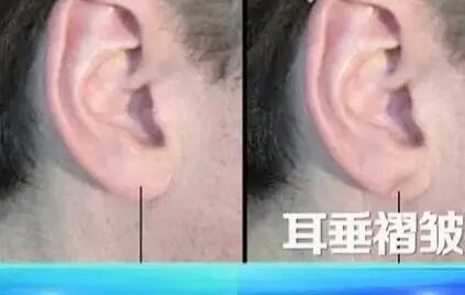 血管不好,从脸上能看出来!有这6个症状的人一定要提高警惕 血管不好,从脸上能看出来!有这6个症状的人一定要提高警惕