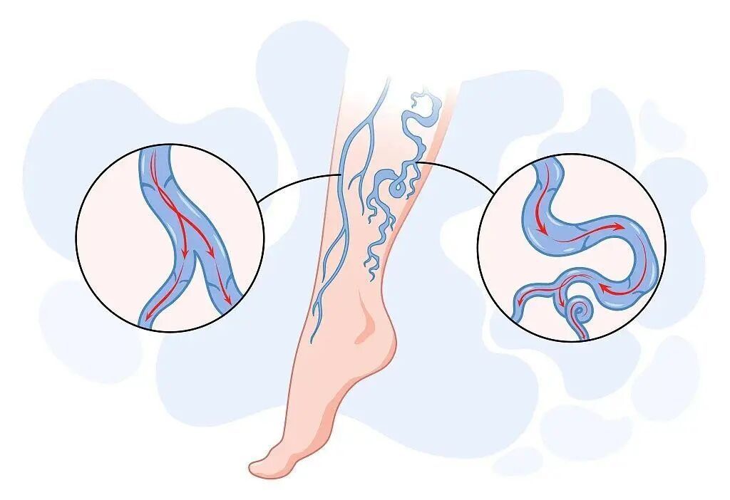 血管不好,从脸上能看出来!有这6个症状的人一定要提高警惕 血管不好,从脸上能看出来!有这6个症状的人一定要提高警惕