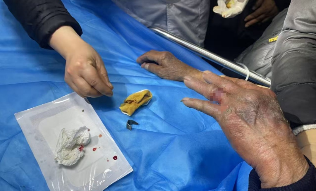 老人中毒被急送医院,手上的它却成救治“拦路虎” 老人中毒被急送医院,手上的它却成救治“拦路虎”