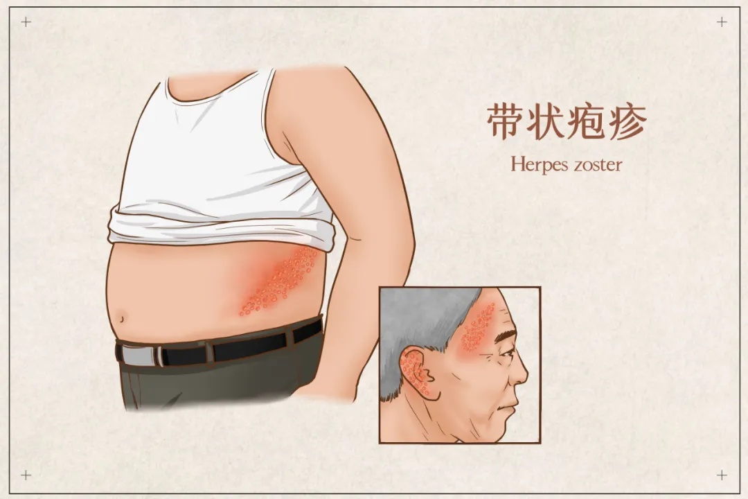 每年冬天杭州都有不少人中招,剧痛难忍......尽早去正规医院! 每年冬天杭州都有不少人中招,剧痛难忍......尽早去正规医院!