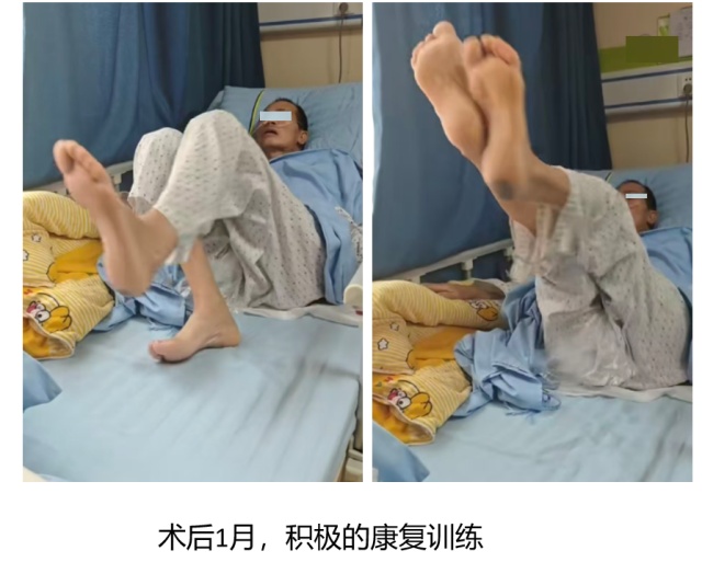 惊心动魄!60岁老人因意外“头颈分离”直送ICU 惊心动魄!60岁老人因意外“头颈分离”直送ICU