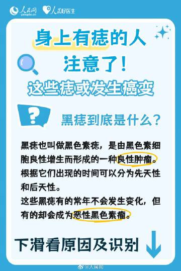 注意了！这些痣可能会发生癌变