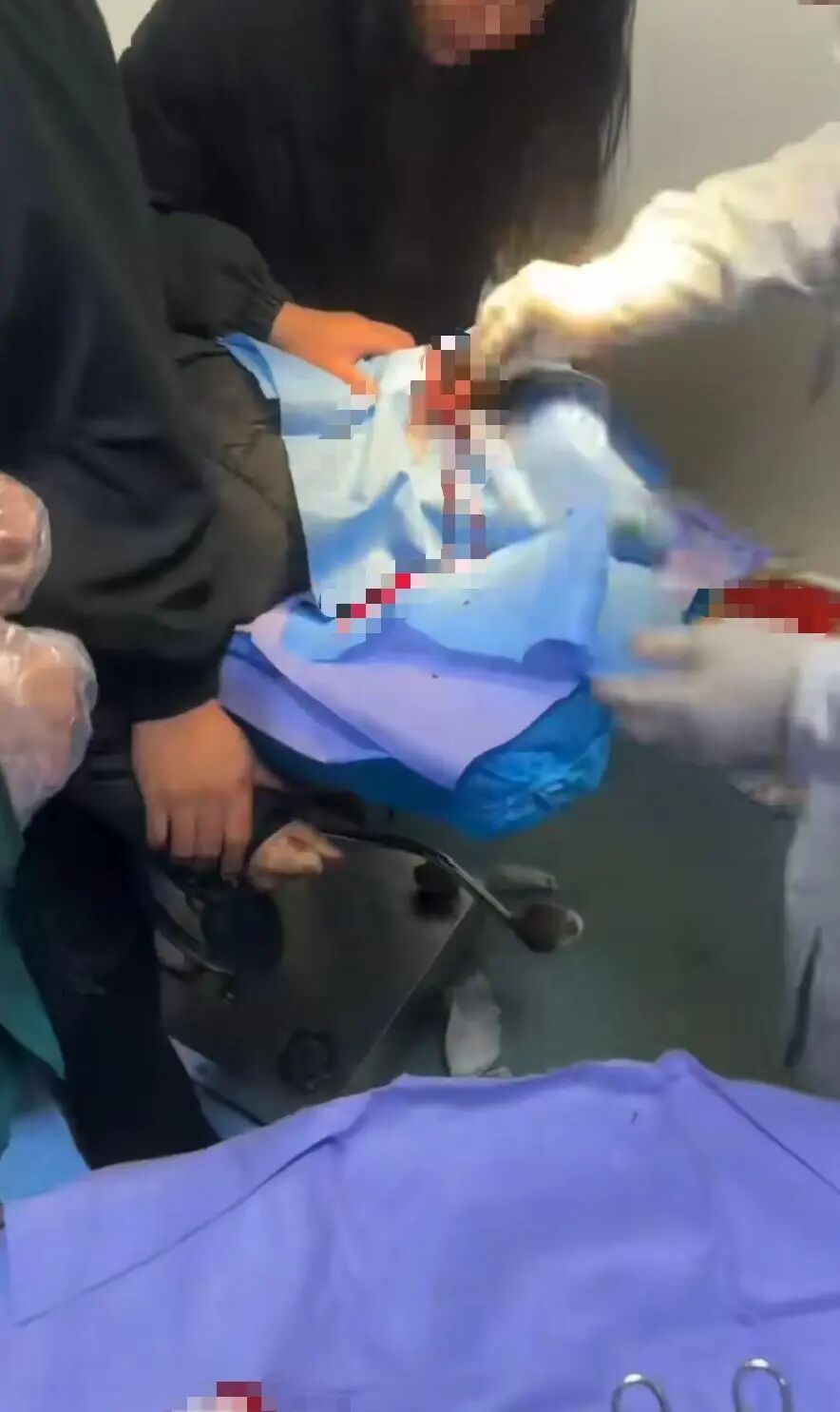 看似温柔的盘发“神器”，有时会成为利刃，一定要小心！