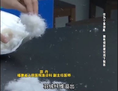 每天穿羽绒服12小时，男子突然呼吸衰竭…肺都变这样了