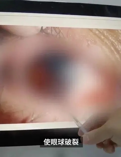 保温杯泡枸杞,竟成“定时炸弹”?! 保温杯泡枸杞,竟成“定时炸弹”?!