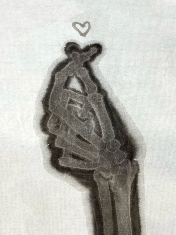 学医和学画的都惊呆了!医生手绘X光片“走红” 学医和学画的都惊呆了!医生手绘X光片“走红”