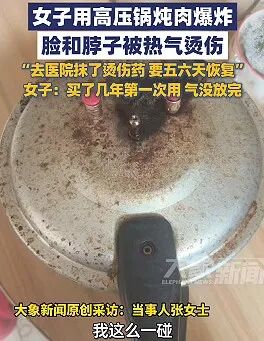 差点毁容！炖肉时它突然爆炸，只因忽视了这一步……