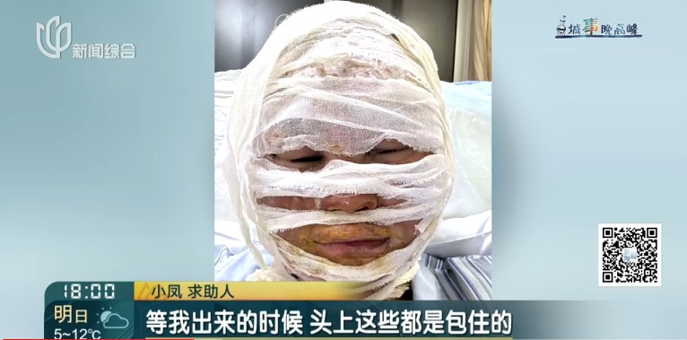 上海一美容院酒精突然爆炸！女子深度烧伤，巨额治疗费无着落…