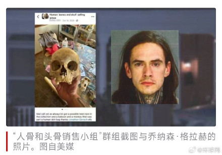 美国男子家搜出超100件人类头骨及大量人类骸骨，有遗骸上仍附着心脏起搏器