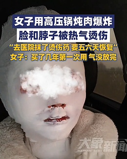 差点毁容！炖肉时它突然爆炸，只因忽视了这一步……