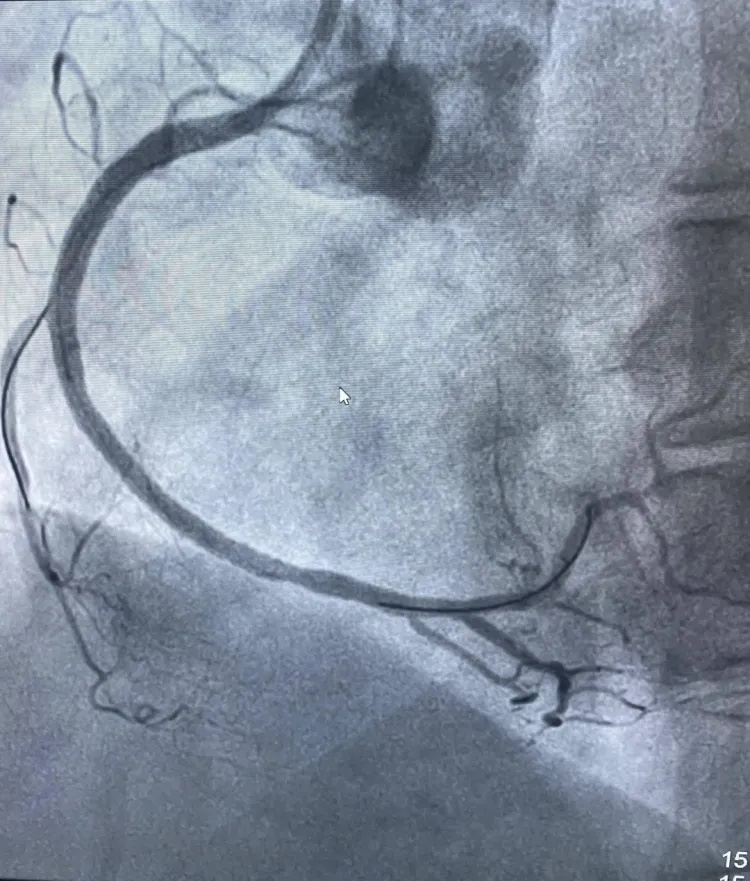 夫妻来浙江旅游因琐事拌嘴，妻子突然捂住胸口……医生：吵架真能气死人