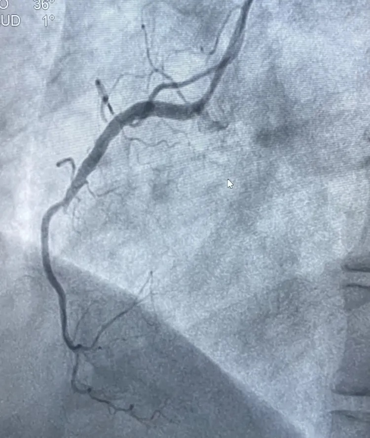 夫妻来浙江旅游因琐事拌嘴，妻子突然捂住胸口……医生：吵架真能气死人