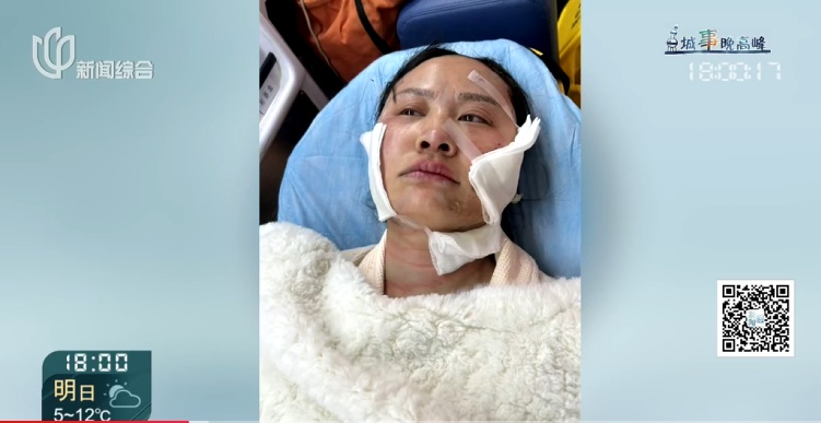 上海一美容院酒精突然爆炸！女子深度烧伤，巨额治疗费无着落…