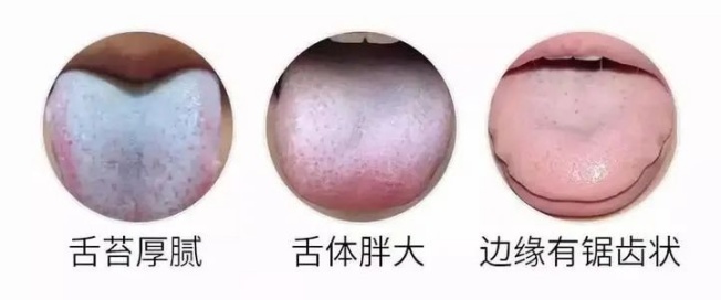 舌头有齿痕，说明这个脏器“虚透”了