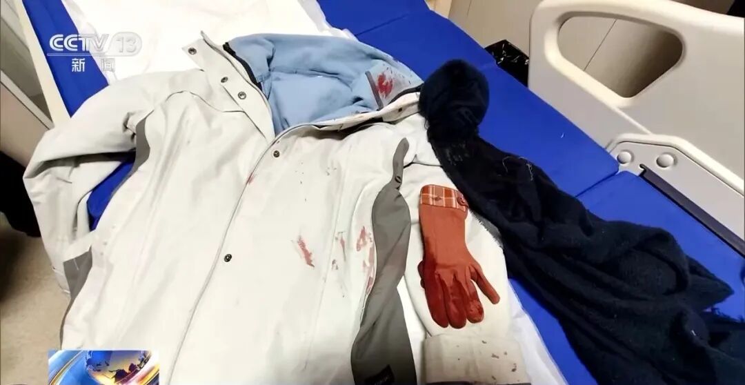 女警徒手夺刀，脸上缝30多针：后怕但不后悔