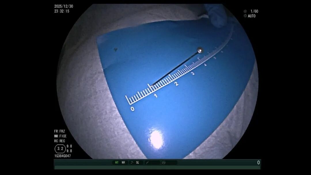 千万别试！这“玩具”突然火了，杀伤力大！11 岁男孩被紧急送医