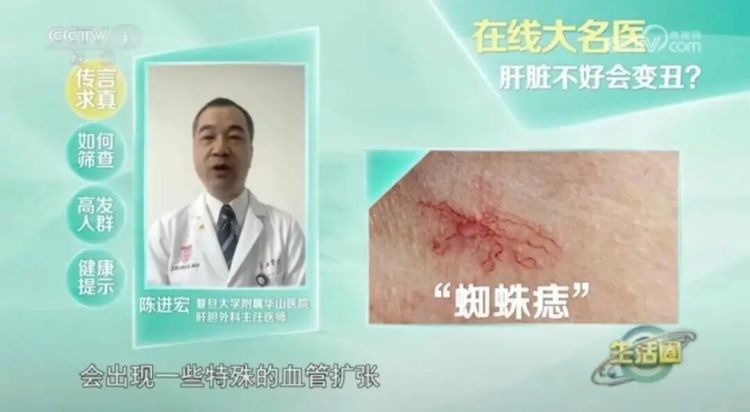 这种面相可能是恶疾前兆！24岁清秀女子样貌突变，"不爱喝奶茶也没遗传史"