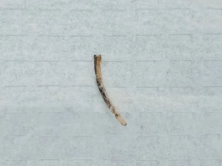 男子鱼刺卡喉误处理 几天后排便刺痛……这些土办法别再用了