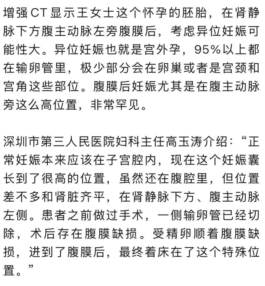 女子怀孕照B超却怎么也找不到“宝宝”！医生检查后惊了：非常罕见…