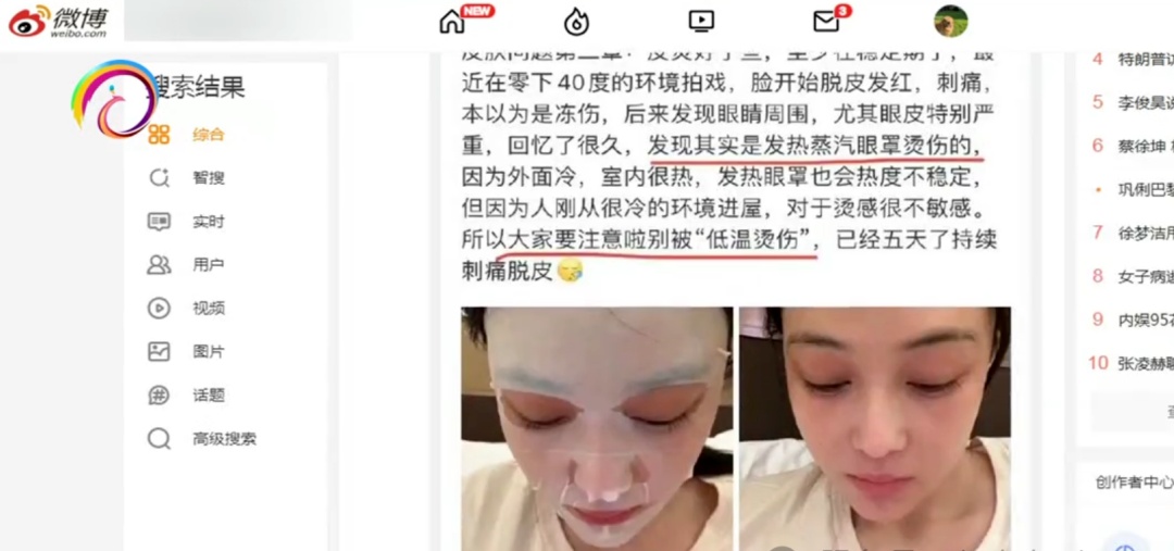 当心！蒸汽眼罩成伤眼刺客，多人使用后被低温灼伤！医生紧急提醒：这类人群尤其要注意