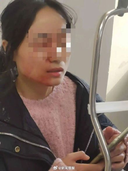 学校通报老师劝架被学生戳伤眼球:教师康复中,已处理涉事学生 学校通报老师劝架被学生戳伤眼球:教师康复中,已处理涉事学生