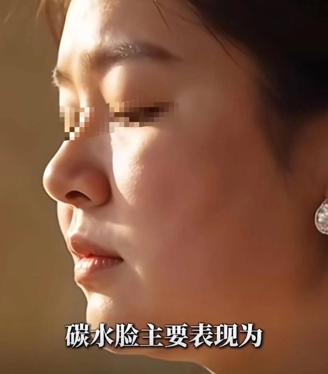 “碳水脸”刷屏引发容貌焦虑 专家：可别戒碳，关键是比例要协调