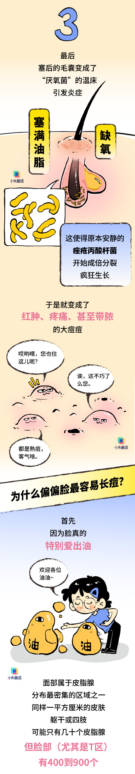 为啥全身上下脸最爱长痘 为啥全身上下脸最爱长痘