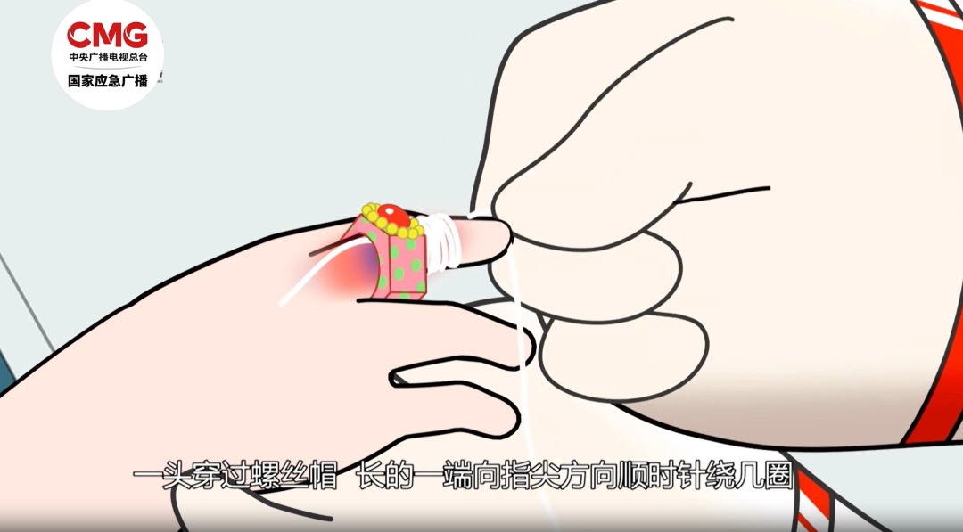 家里这个地方利如刀片！别让这条红痕出现在你家娃身上