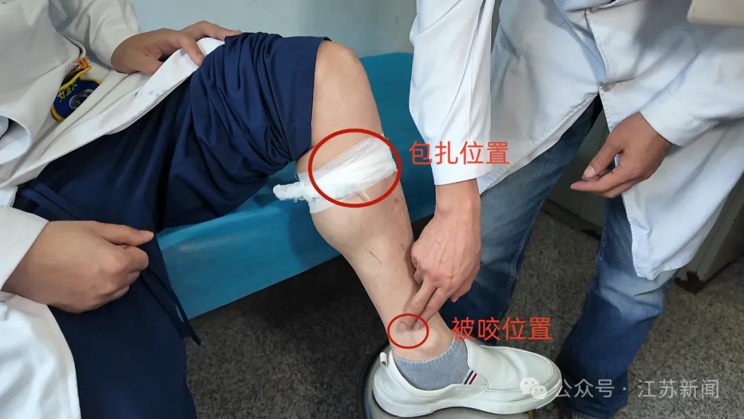 男子田间干活被毒蛇咬伤,几个自救动作获医生点赞!近期蛇咬伤多发,做对急救能保命 男子田间干活被毒蛇咬伤,几个自救动作获医生点赞!近期蛇咬伤多发,做对急救能保命