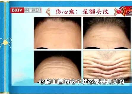 五脏好不好，看脸就知道，5种“危险面相”快自查，每一个都要注意