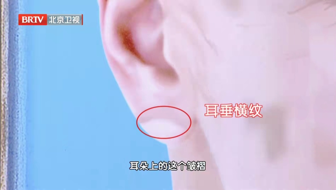 五脏好不好，看脸就知道，5种“危险面相”快自查，每一个都要注意