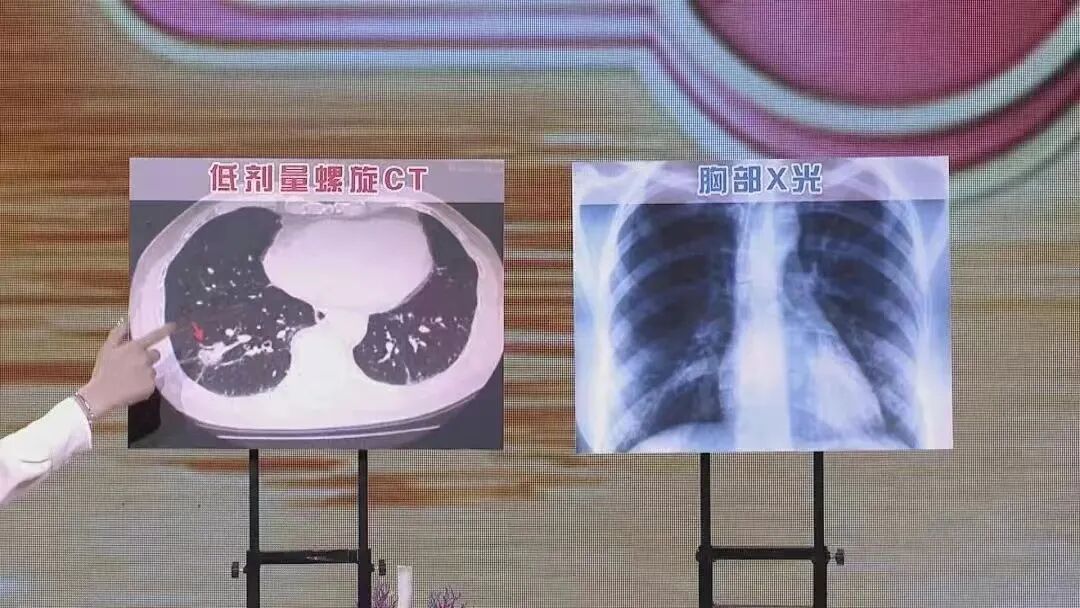 身体给了你这6次防癌机会，别一次次错过！