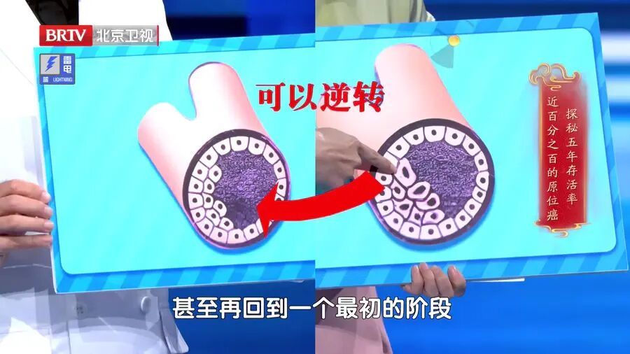 身体给了你这6次防癌机会，别一次次错过！