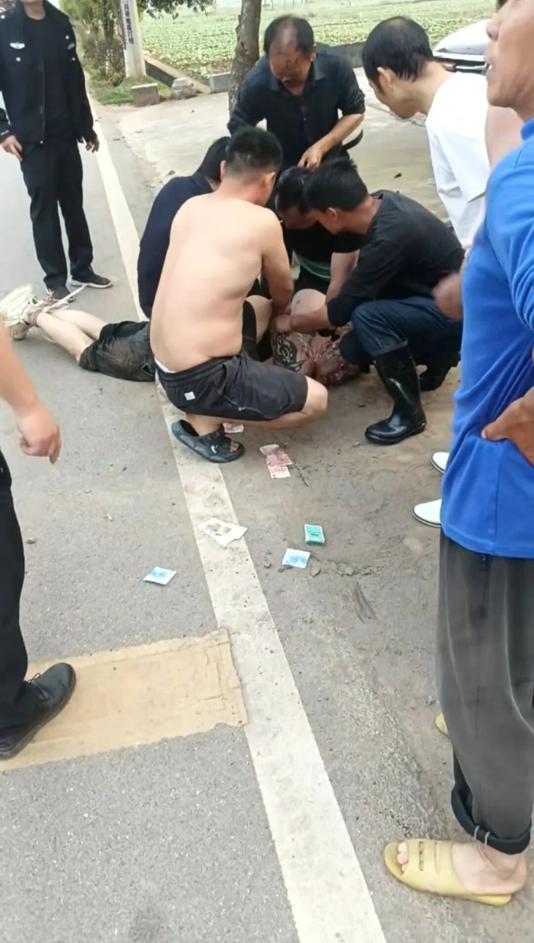 男子当街对女子施暴,69岁大爷制止却被咬掉鼻子,但他始终没松手直到民警到来 男子当街对女子施暴,69岁大爷制止却被咬掉鼻子,但他始终没松手直到民警到来