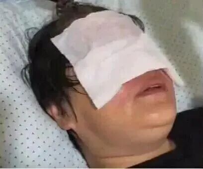 4岁男孩把打火机扔进热水壶,外婆被“炸”进医院,惨遭“毁容”!紧急提醒 4岁男孩把打火机扔进热水壶,外婆被“炸”进医院,惨遭“毁容”!紧急提醒