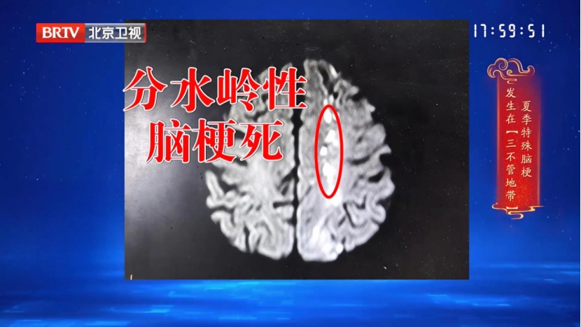 高温天伤心脑、又毁肾的2个喝水习惯,很多人第一个就中招 高温天伤心脑、又毁肾的2个喝水习惯,很多人第一个就中招