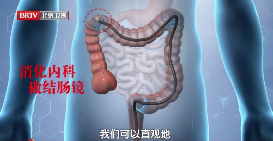 给肠道“减压”的食物,医生建议要多吃,排便又快又干净,还能防便秘 给肠道“减压”的食物,医生建议要多吃,排便又快又干净,还能防便秘