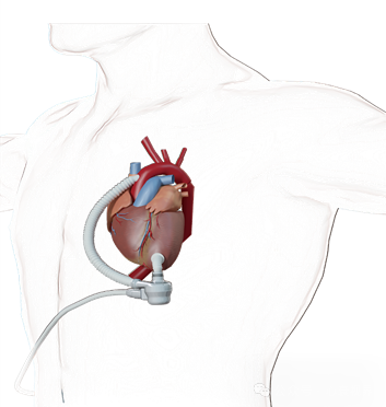 阜外医院王现强:让患者重获“心”生 阜外医院王现强:让患者重获“心”生